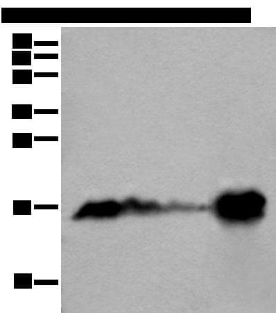 MB / Myoglobin Antibody