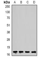 Polyclonal Rabbit anti-Human CFL2 / Cofilin 2 Antibody (IF, WB)