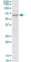 IHC-plus™ CTNS / Cystinosin Antibody (clone 5G6)