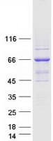 Human ZAP70 Protein (Recombinant Myc-DDK (Flag))