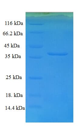 Drosophila melanogaster Bursicon Protein (Recombinant GST)
