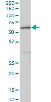 Monoclonal Mouse anti-Human STK38 Antibody (clone 2F6, IHC, IF, WB)