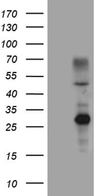 CSA / ERCC8 Antibody (clone OTI5C9)