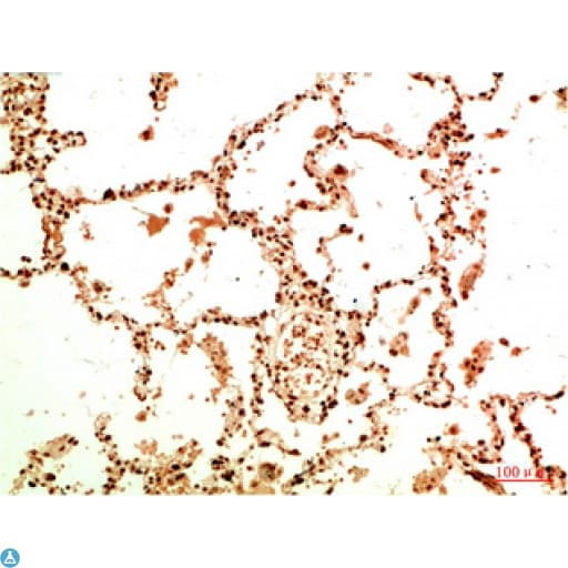 RELA / NFKB p65 Antibody