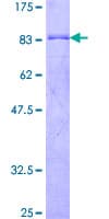 Human EFS / CASS3 Protein (Recombinant GST)