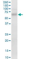 FZD7 / Frizzled 7 Antibody (clone 4D9)