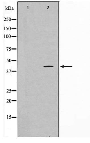 Polyclonal Rabbit anti-Human TBX1 Antibody (IF, WB)