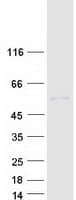 Human MICB Protein (Recombinant Myc-DDK (Flag))