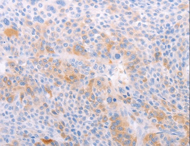 IHC-plus™ S1PR4 / SIP4 / EDG6 Antibody