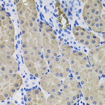 Polyclonal Rabbit anti-Human ACVR2 / ACVR2A Antibody (IHC, WB)