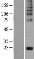 GKN2 / Gastrokine 2 Protein (Over-Expression Lysate Myc-DDK (Flag))
