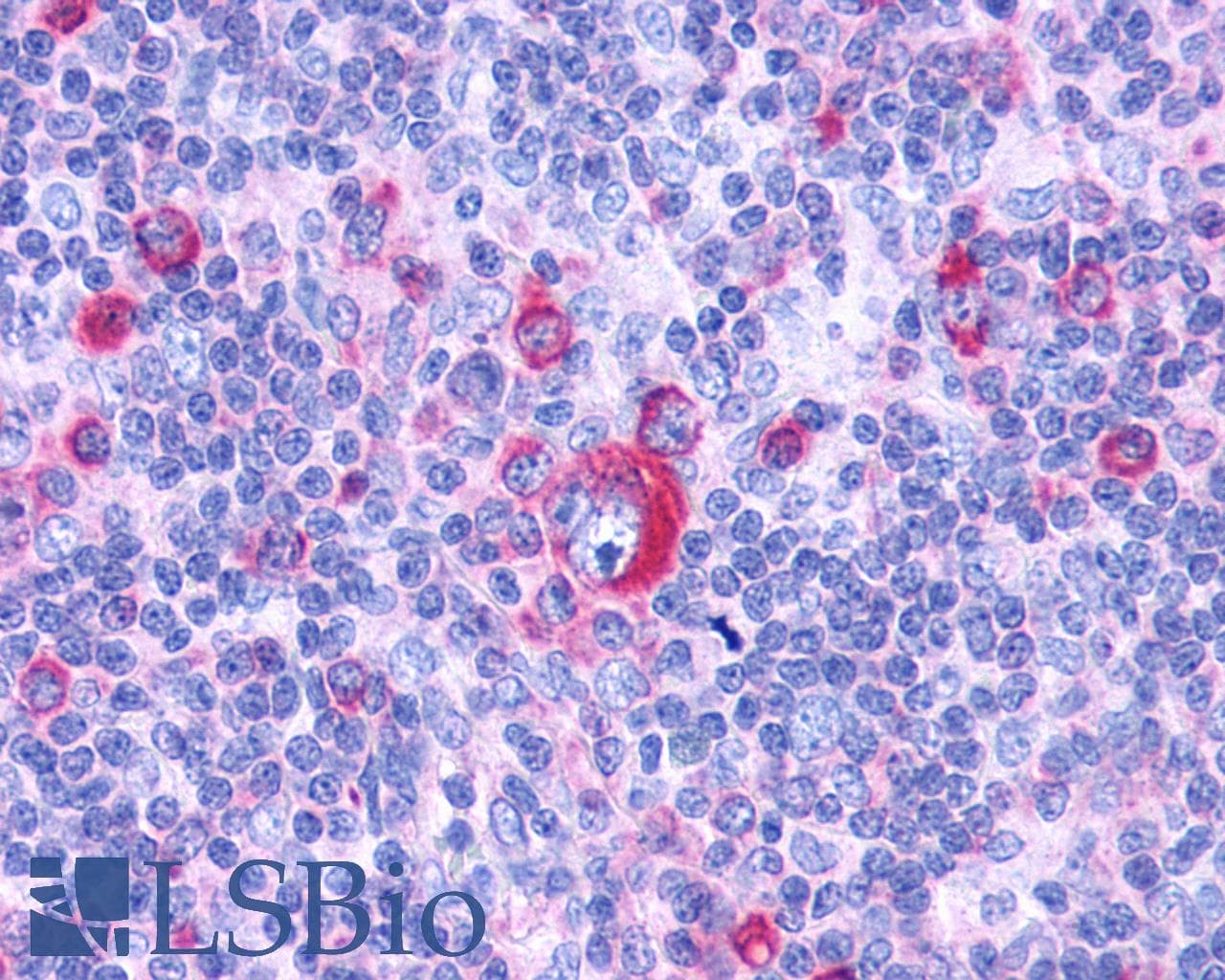 PathPlus™ GPR132 / G2A Antibody (Cytoplasmic Domain)