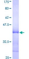 Human MURF1 / IRF Protein (Recombinant GST, N-terminus)