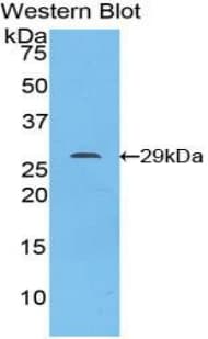 STAT6 Antibody (aa410-623, Cy3)