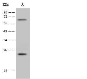 Polyclonal Rabbit anti-Human HSD17B11 Antibody (Preservative Free, WB)