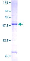 Human CSH1 / Placental Lactogen Protein (Recombinant GST)