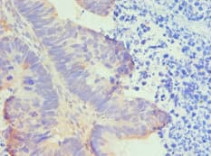 HTRA2 / OMI Antibody (aa334-458)
