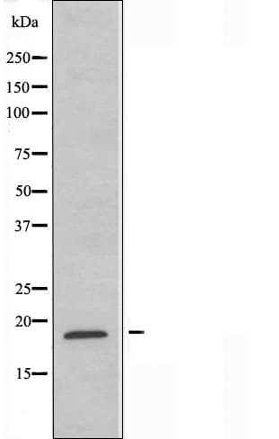 RPL12 / Ribosomal Protein L12 Antibody