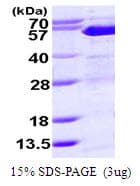Human SUFU Protein (Recombinant His)