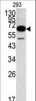 Polyclonal Rabbit anti-Human METAP2 Antibody (aa10-40, WB)