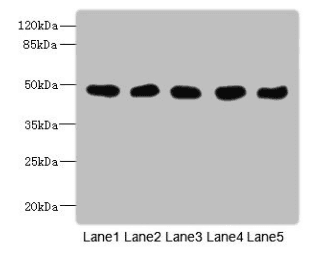 GCD / GCDH Antibody