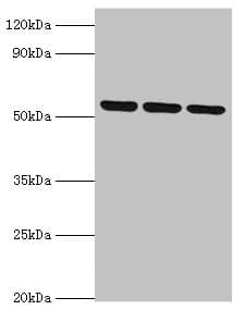 Polyclonal Rabbit anti-Human MYOT / Myotilin Antibody (aa443-498, IHC, WB)