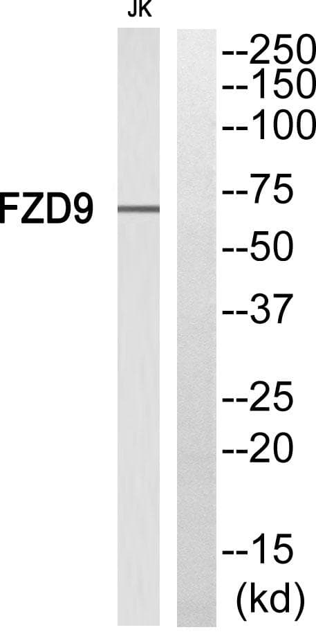 Polyclonal Rabbit anti-Human FZD9 / Frizzled 9 Antibody (WB)