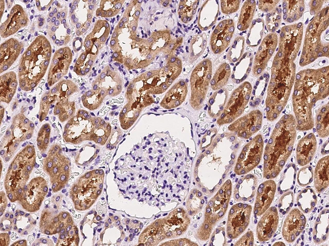 APH / APEH Antibody