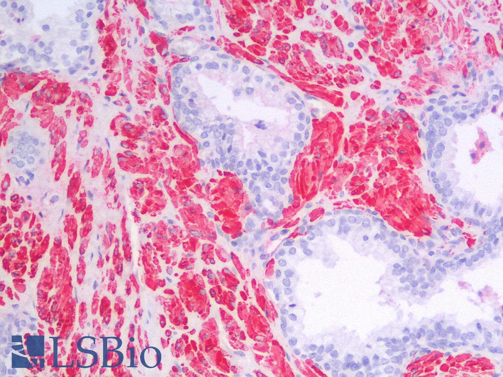 IHC-plus™ Recombinant Monoclonal Rabbit anti-Human CALD1 / Caldesmon Antibody (clone CALD1/1424R, IHC)