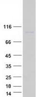 Human LRRC8D / LRRC5 Protein (Recombinant Myc-DDK (Flag))