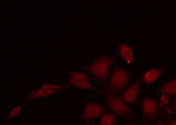 Polyclonal Rabbit anti-Human CARP / ANKRD1 Antibody (IF, WB)