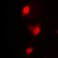 CCNB1 / Cyclin B1 Antibody (Internal)