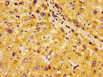 CLDN6 / Claudin 6 Antibody
