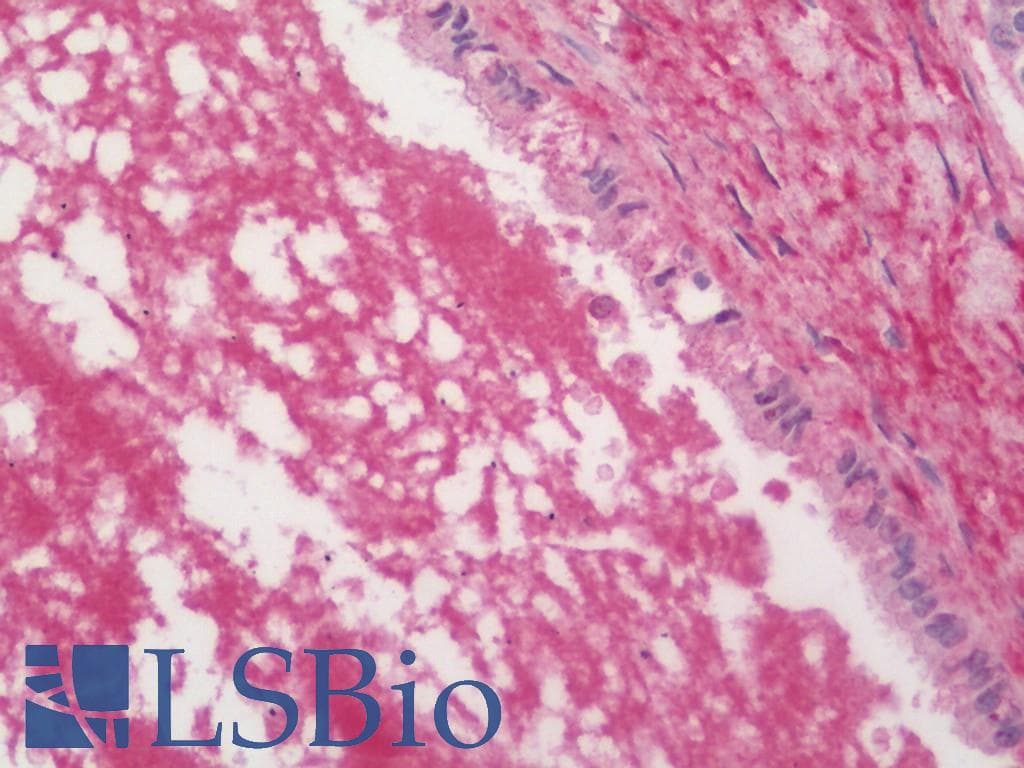 AMBP Antibody (Biotin)