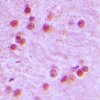 FOXR1 Antibody (C-Terminus)