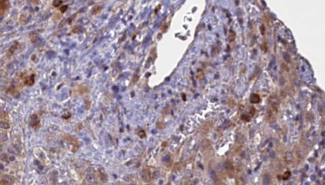 Polyclonal Rabbit anti-Human GABRA2 Antibody (IHC, IF, WB)