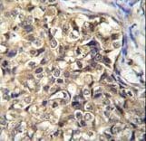 KLHL35 Antibody (aa301-328)