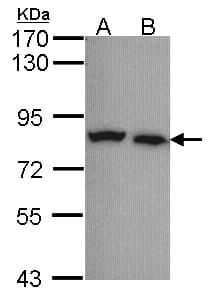 Polyclonal Rabbit anti-Human CAPN5 / Calpain 5 Antibody (aa1-381, WB)