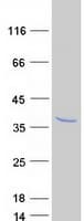 Human CAPNS2 Protein (Recombinant Myc-DDK (Flag))