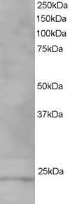 VPS28 Antibody (aa209-221)