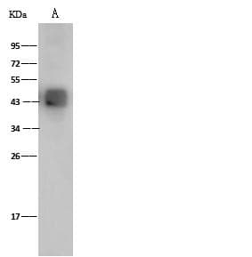 Dengue Virus Type 2 Envelope Antibody (Preservative Free)