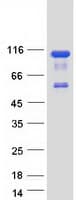 Human OSBPL9 Protein (Recombinant Myc-DDK (Flag))
