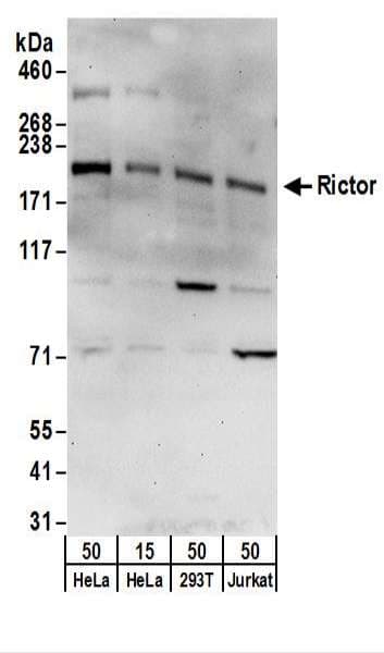 RICTOR Antibody (aa1-50)