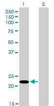 SRSF10 / FUSIP1 Antibody (clone 1A6)