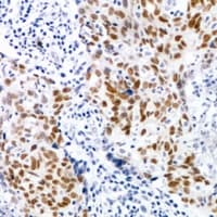 Polyclonal Rabbit anti-Human CDK7 Antibody (IHC, WB)