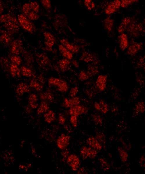 CHTF18 / RUVBL Antibody (aa25-75)
