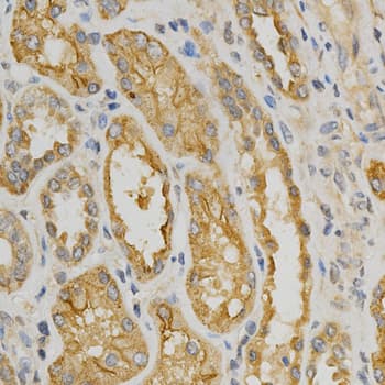 Polyclonal Rabbit anti-Human NOX4 Antibody (IHC, IF, WB)