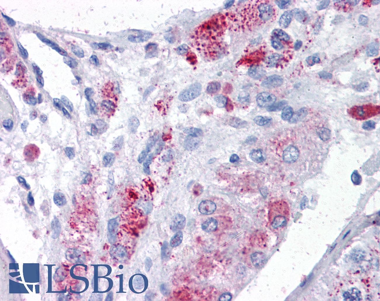 IHC-plus™ MTA1 Antibody (Internal)