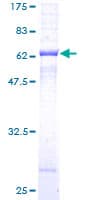 Human SGCB / SGC / Sarcoglycan Beta Protein (Recombinant GST)