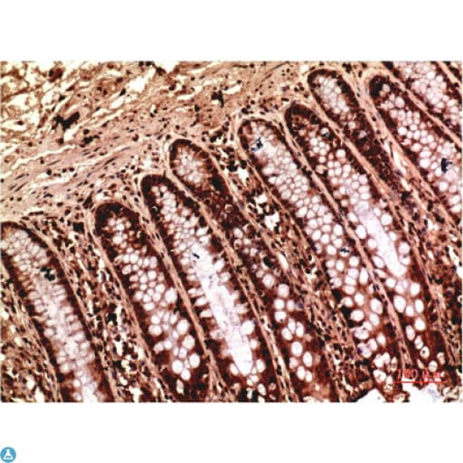 Monoclonal Mouse anti-Human TUBG1 / Tubulin Gamma 1 Antibody (IHC, WB)